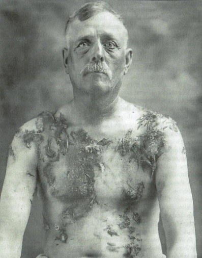 1918 年 XNUMX 月，一名德裔美国人在被鞭打、涂上焦油和羽毛后